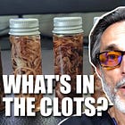 Calamari Clots Part 3: A Unique and Dangerous Protein Signature