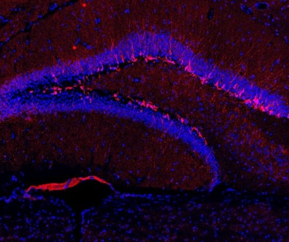 Neuroscience News Science Magazine - Research Articles - Psychology  Neurology Brains AI