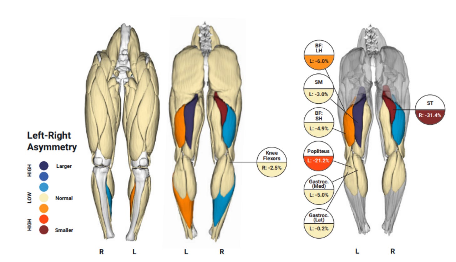Immunis Partners with Springbok Analytics on MRI-based AI Muscle Analysis Technology | Imaging Technology News Immunis Partners with Springbok Analytics on MRI-based AI Muscle Analysis Technology | Imaging Technology News