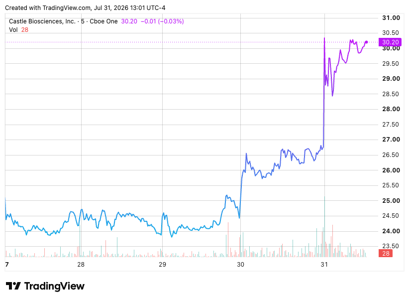 TradingView chart TradingView chart