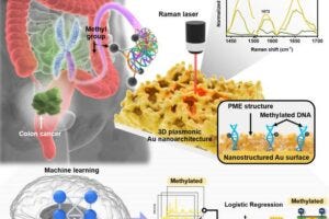 Illustration of the high-sensitivity detection of trace amounts of cancer DNA in blood and its analysis using an AI-based method.