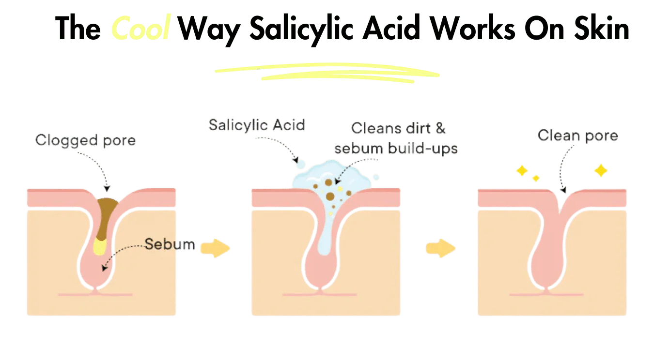 Salicylic Acid in Skincare: Clearer Skin Ahead 2026 Salicylic Acid in Skincare: Clearer Skin Ahead 2026