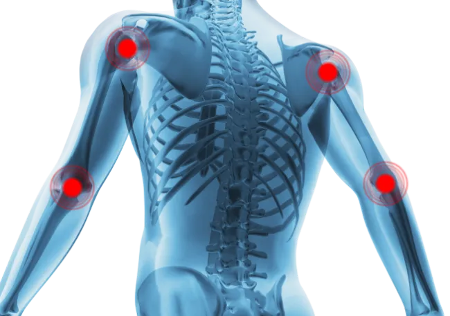 Autoimmunity Autoimmunity