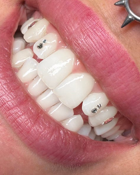 tooth gems italy milan kola payer