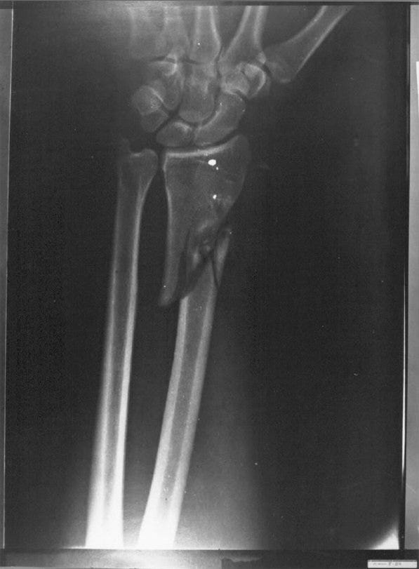 Incredible Wounds of Governor Connally | JFK Boards Incredible Wounds of Governor Connally | JFK Boards