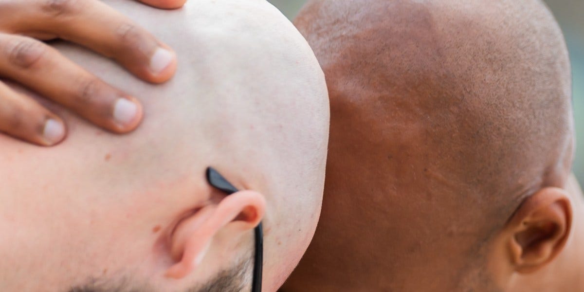 Forget GLP-1 stocks, baldness drugs are Wall Street’s next goldmine Forget GLP-1 stocks, baldness drugs are Wall Street’s next goldmine