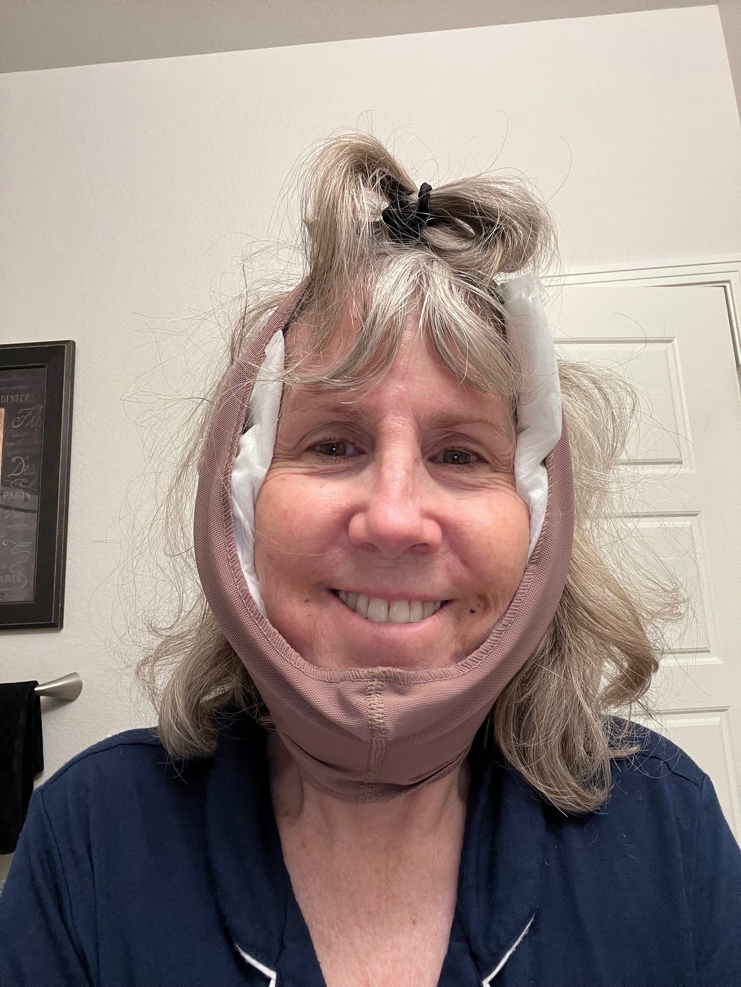 Author after getting facelift. Her face is all bandages and her hair is a mess.