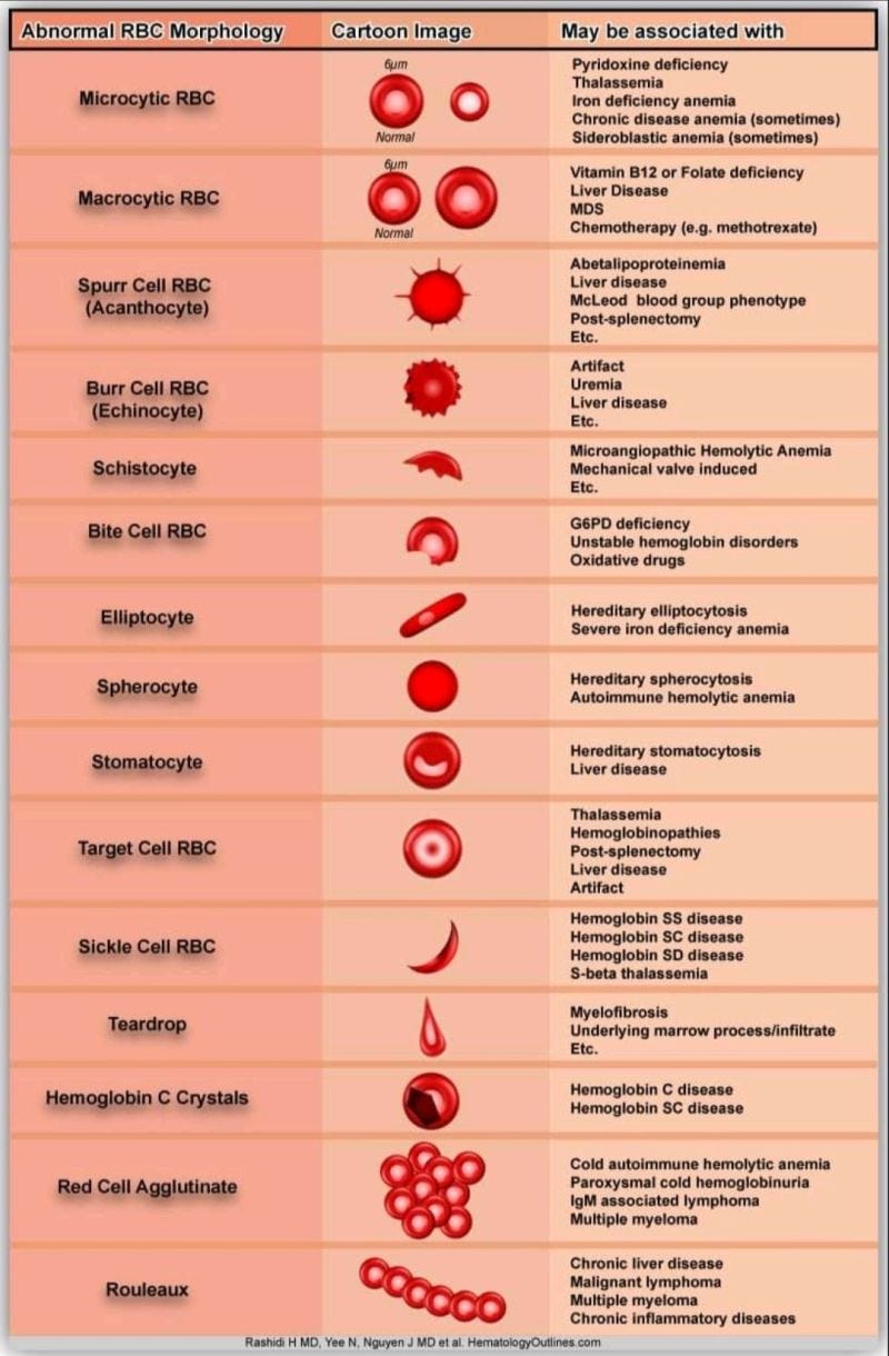 Spicalated Rbc Abnormal RBCs Morphology with most common causes