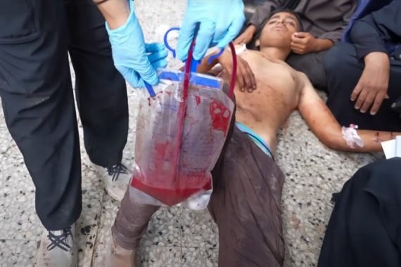 An injured boy lies on the ground in al-Shifa hospital. While doctors are still doing surgery, blockades, bombing, and starvation have all but dried up life-saving blood supply
