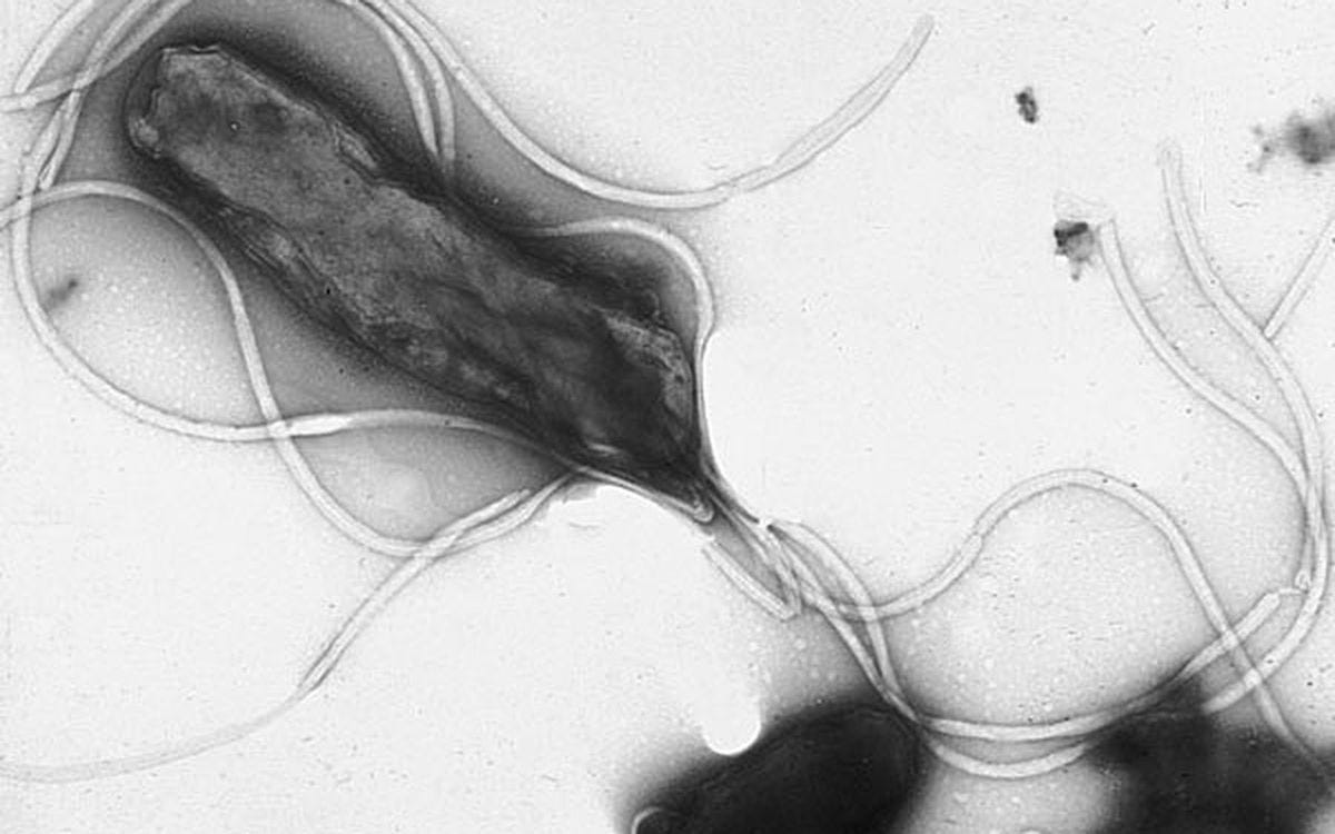 Electron micrograph of Helicobacter pylori Electron micrograph of Helicobacter pylori