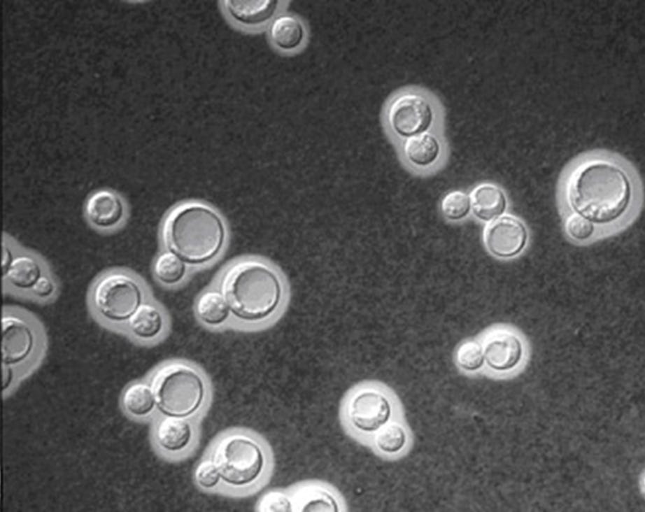 Cryptococcus neoformans » Fungi » Pathogen Profile Dictionary