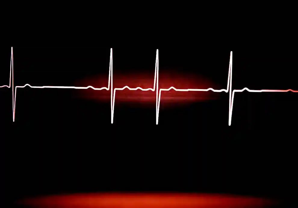 A signal from an (EKG) Electrocardiogram Test showing rapid heart beat