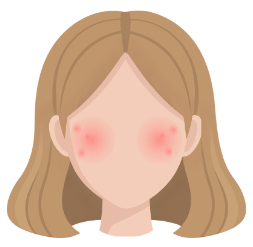 Inflammatory rosacea