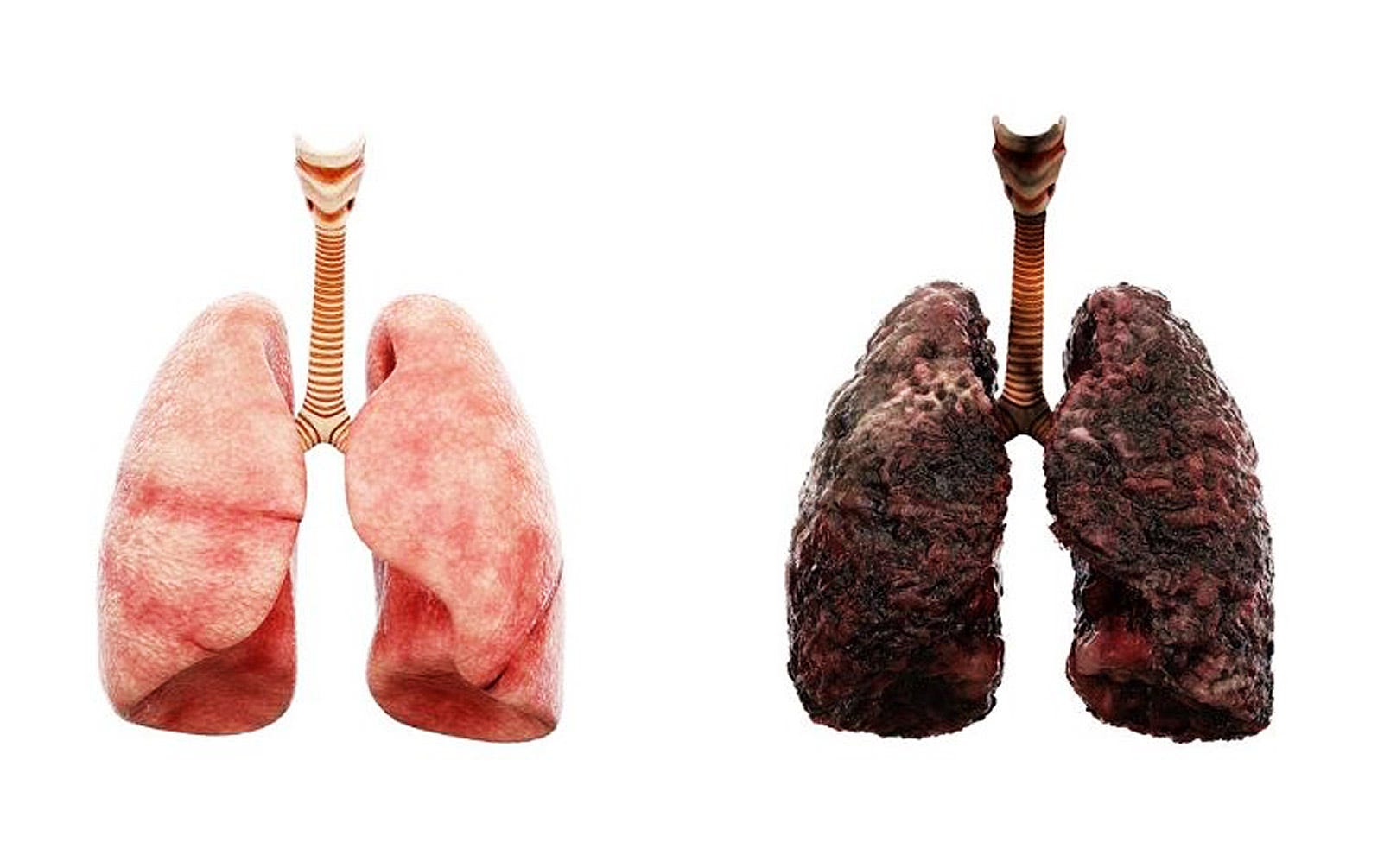 anxiety after quitting chewing tobacco What Happens When You Stop Smoking?