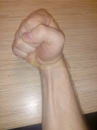 File:Musculus palmaris longus OlejyKKK.jpg - Wikimedia Commons