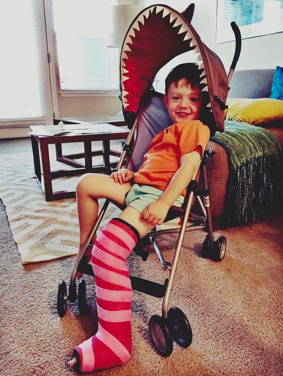 Leo in stroller with cast