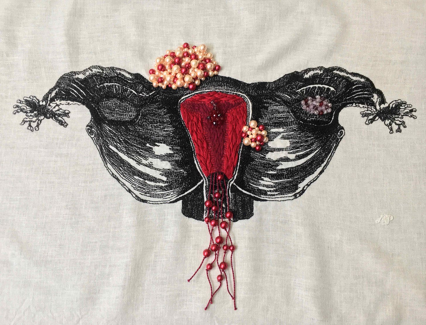 Bleeding Vessel (2022). An embroidery of a uterus, Fallopian tubes, & ovaries, in black thread on white linen textured like a woodcut. The endometrium is in thick bright red & burgundy. Two fibroids are beaded in red, pink, & cream. A cyst on the right ovary is in clear, purple, & red beads. A polyp in dark red & purple beads is inside the uterus. Long burgundy strings with red beads hang from the bottom.