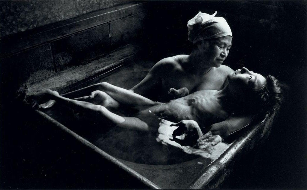 W. Eugene Smith | Tomoko in her bath, Minamata, Japan, 1972 | MutualArt