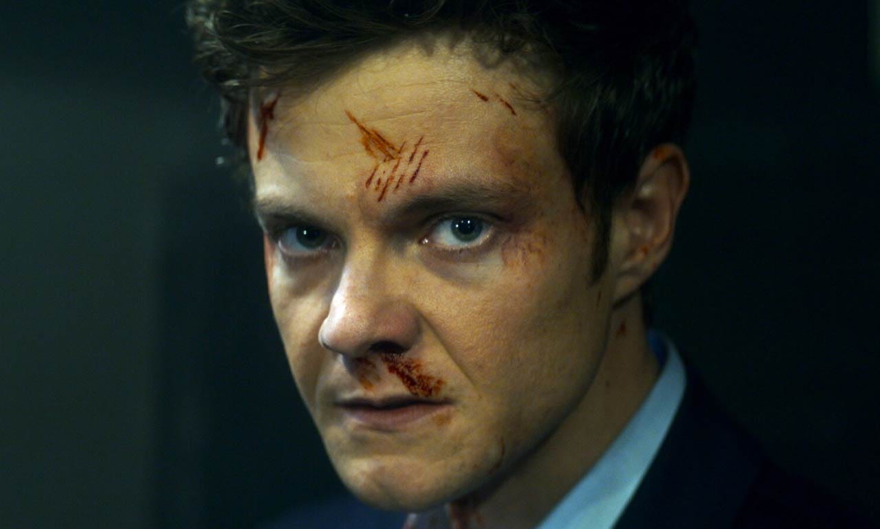 Crítica: Sin dolor (Novocaine) - Rolling Stone en Español