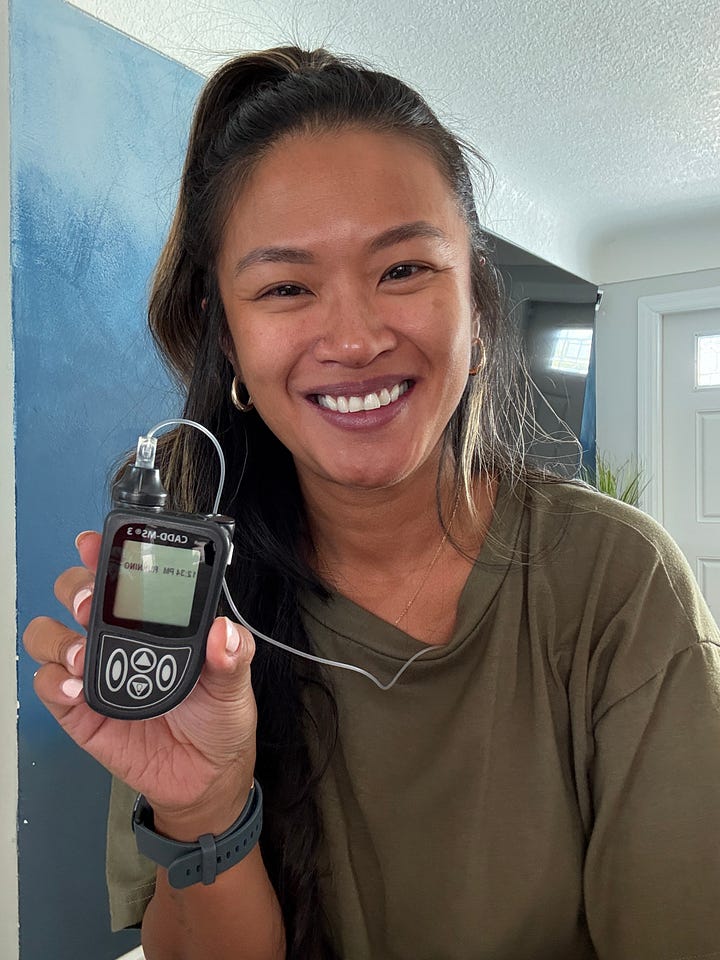 Photos of Gerry with CADD MS3 pump (left) vs Remunity Pro pump (right)