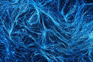 Alzheimer's microglia