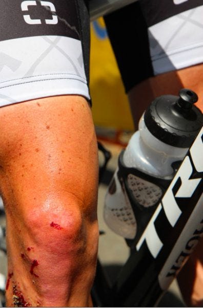Gavin Mannion Bontrager leg
