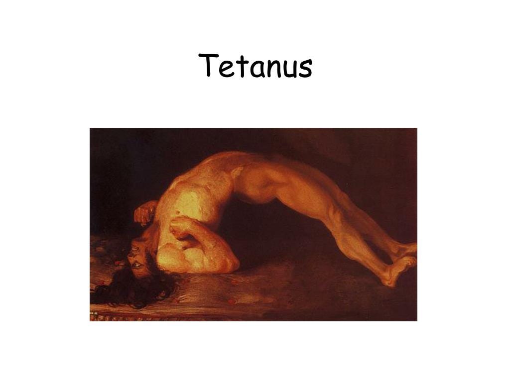 Tetanus shot how often child