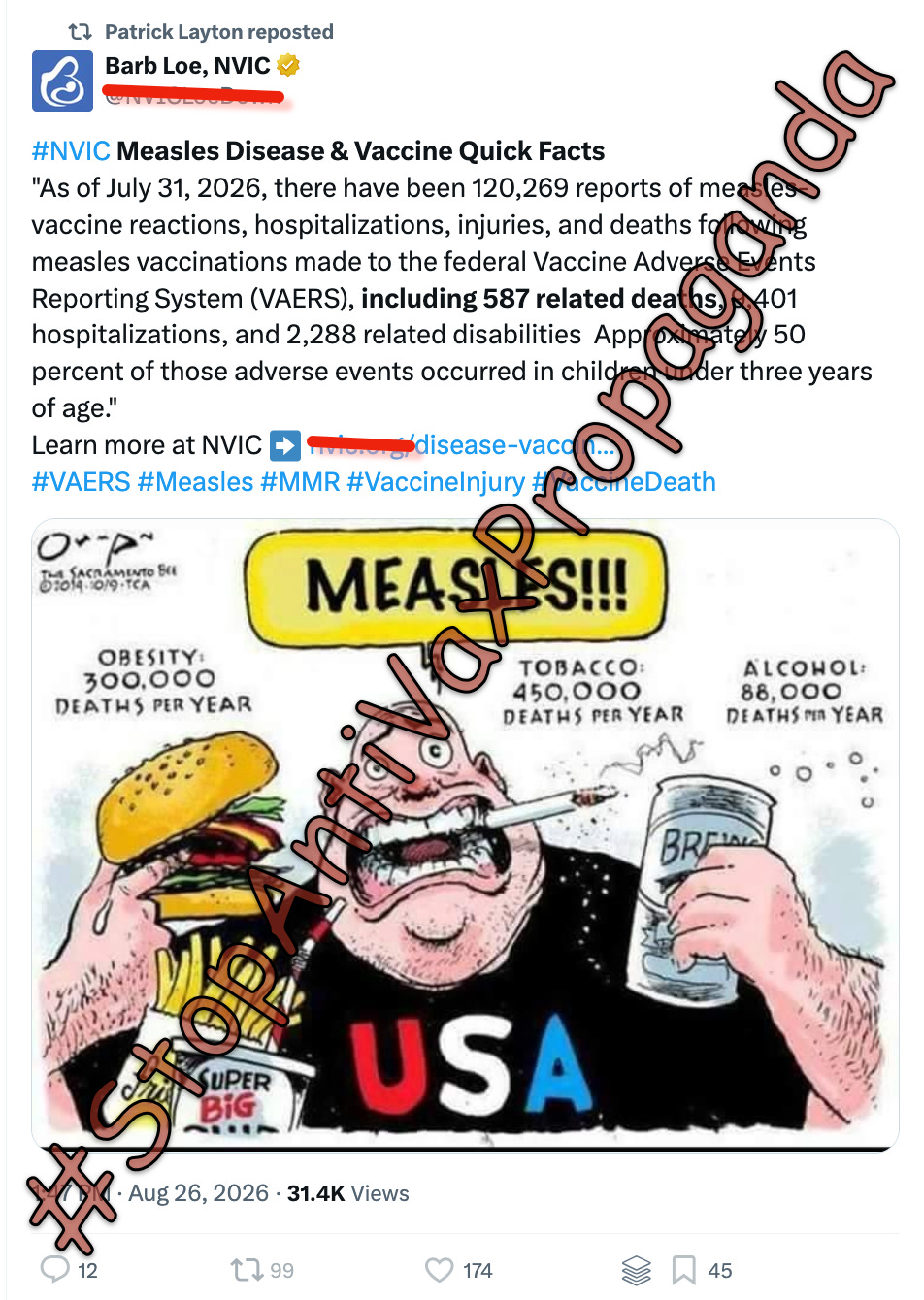 Barb Loe and her NVIC are taking advantage of the death of a baby with measles to push their propaganda about measles vaccine deaths.