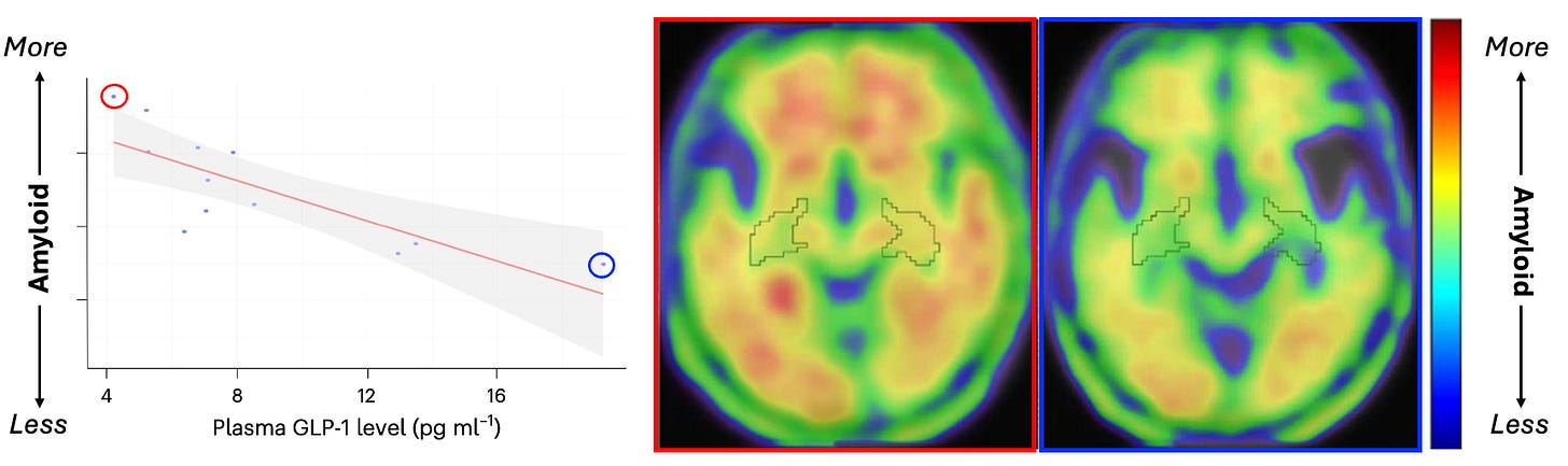glp 1 and pet scan GLP-1 vs Amyloid: Could 'Ozempic' Defend the Aging Brain?