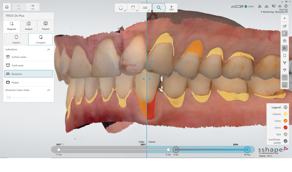 3Shape unveils revolutionary TRIOS 6 Intraoral Scanner and software