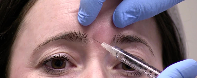 Botox Injection | Journal of Medical Insight Botox Injection | Journal of Medical Insight