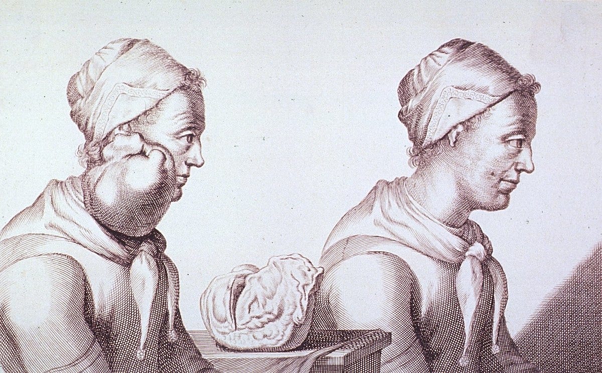 History of cancer - Wikipedia