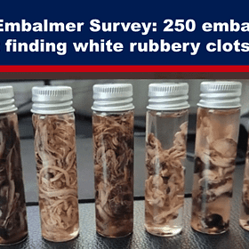 Worldwide Embalmer Survey: 250 Embalmers Report Finding White Rubbery Clots 