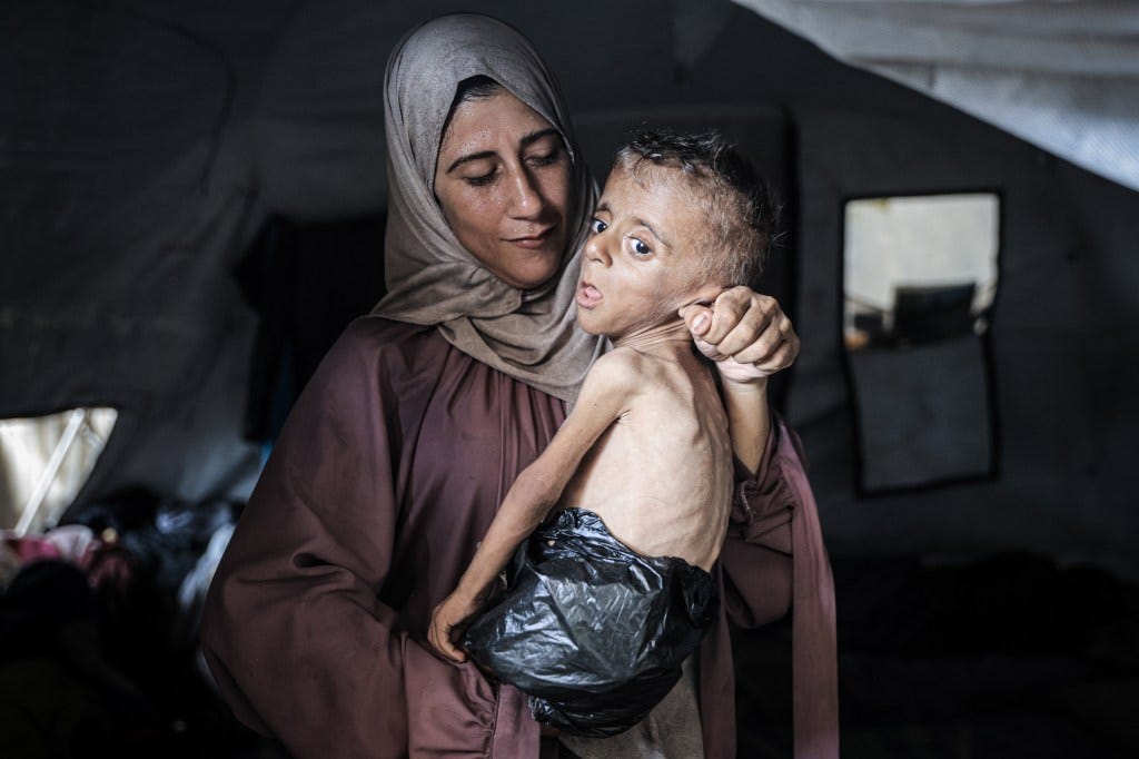 Malnourished Palestinian toddler held by his mother in a Gaza City tent.