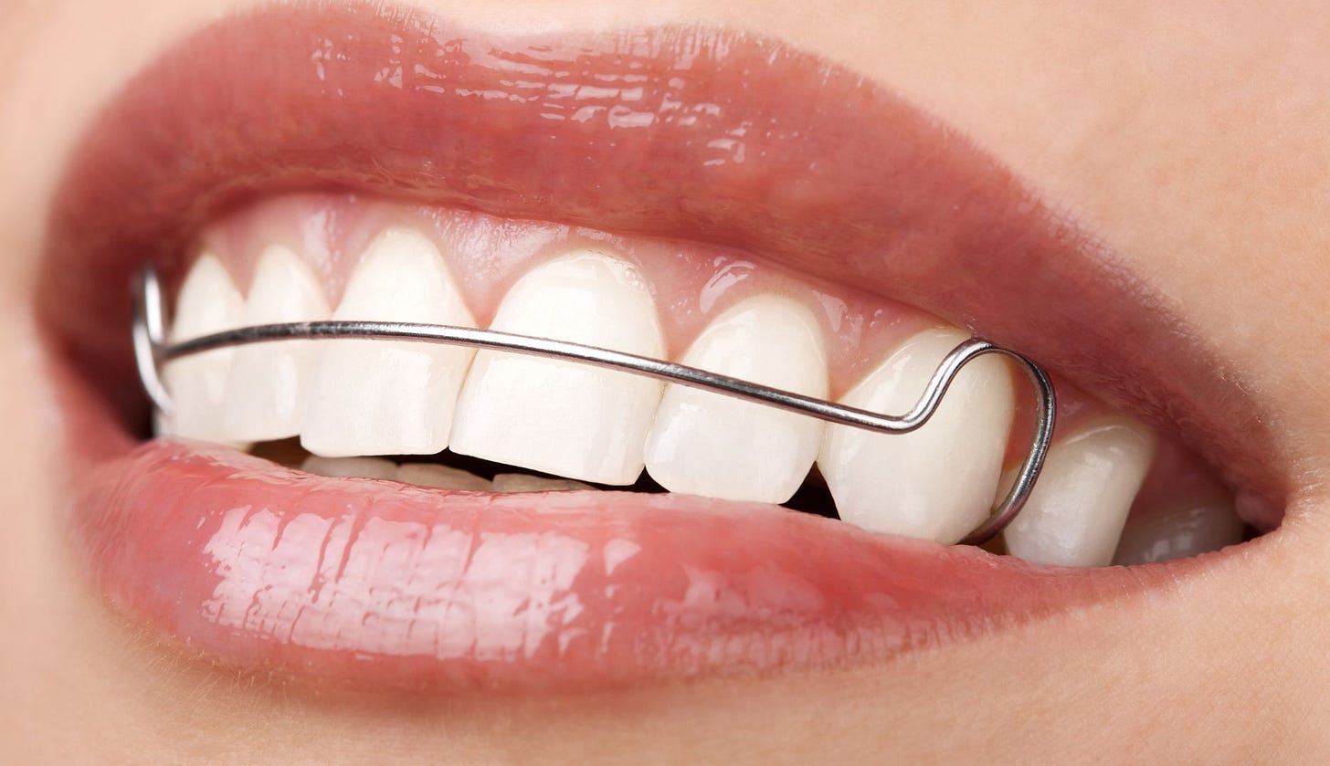 What are hawley retainers? - Iriston House Dental Practice