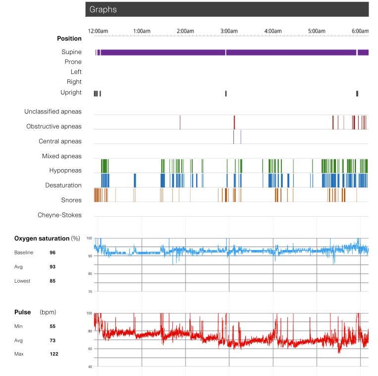 Sleep study chart.png