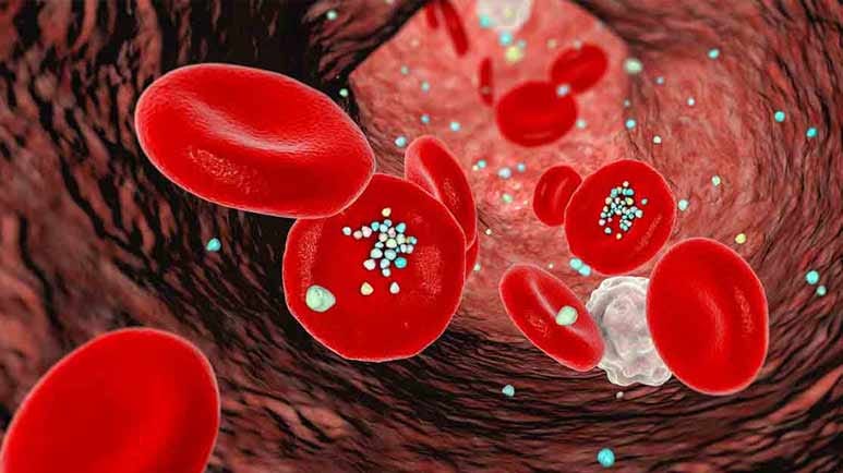 microplastics arterial plaque microplastics arterial plaque