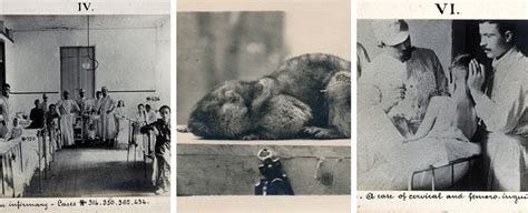 Third Plague Pandemic: Over 2,000 Photos Made Available to Public - CRASSH
