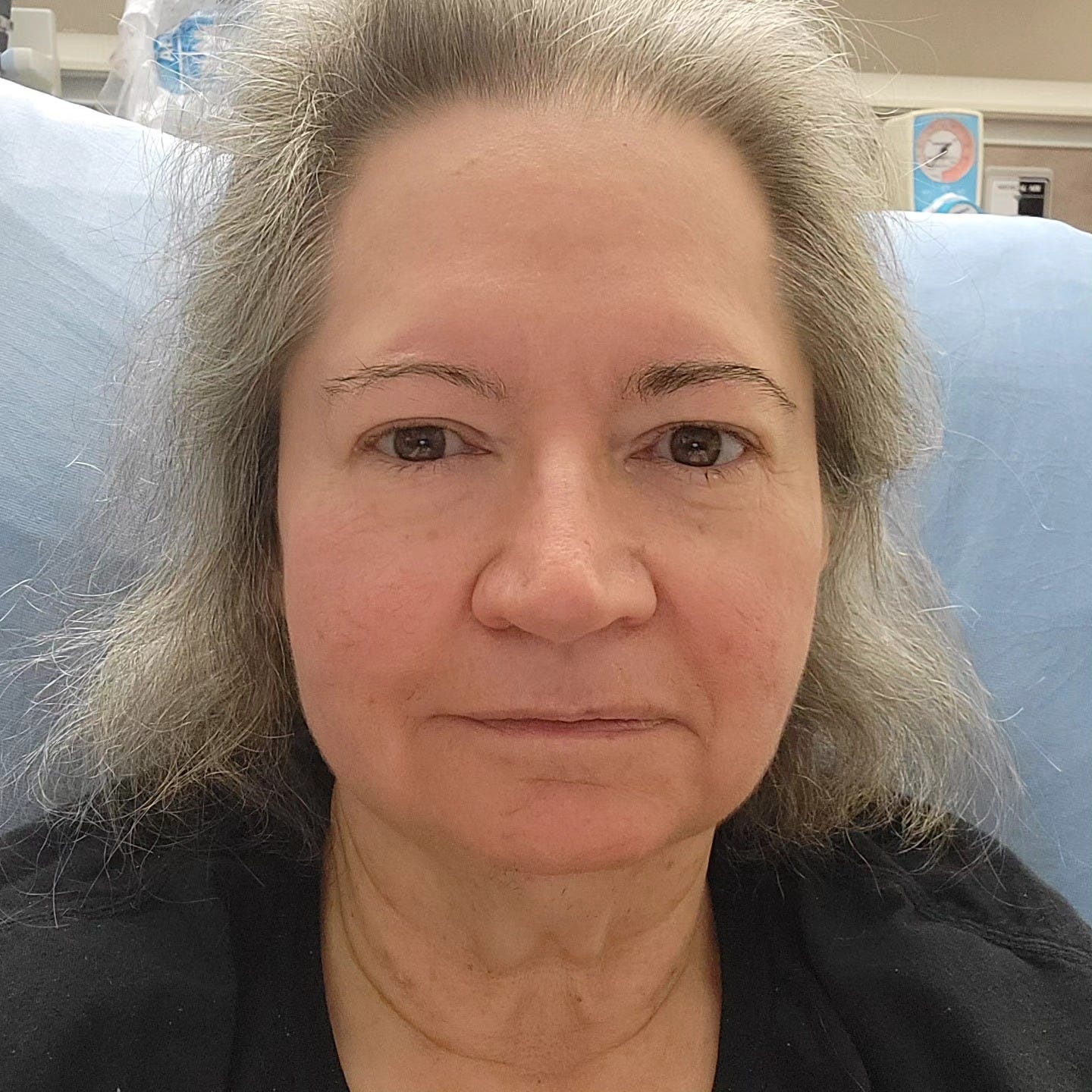 woman with salt and pepper hair and big eyes in a hospital bed woman with salt and pepper hair and big eyes in a hospital bed