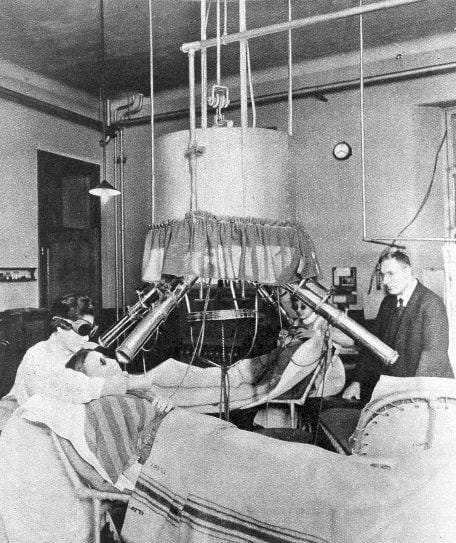 Finsen lamp treatment, London 1925