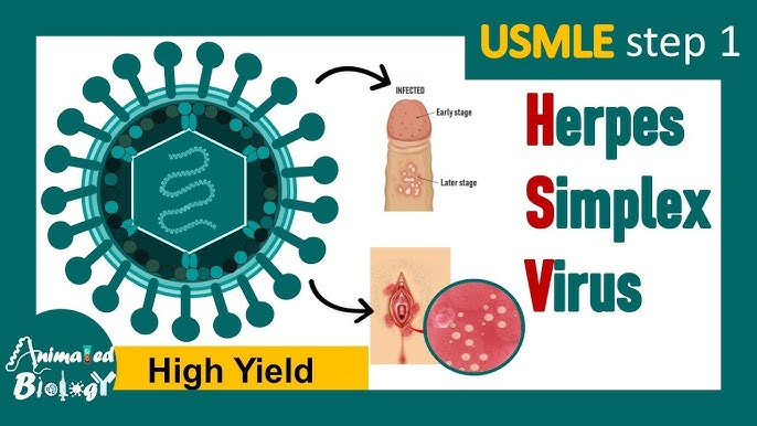 Herpes | Herpes simplex virus (HSV) | Infection , pathogenesis, diagnosis  and treatment of HSV