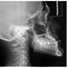 The Curse of Diagnosis Trauma