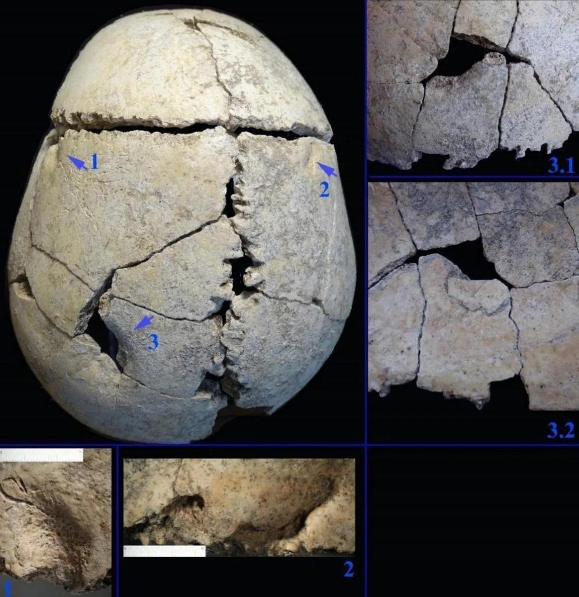 6,000-year-old skeleton reveals survival after a violent lion attack in ancient Bulgaria