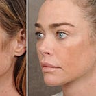 What's with all the facelifts lately?