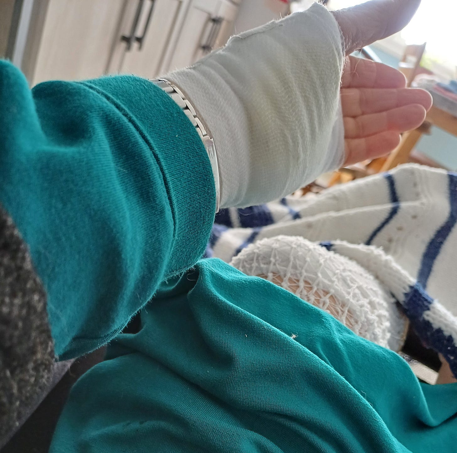 The author's bandaged hand and knee