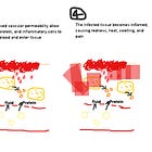 Battle at the Scratch Site: The Innate Immune Army Strikes Again!