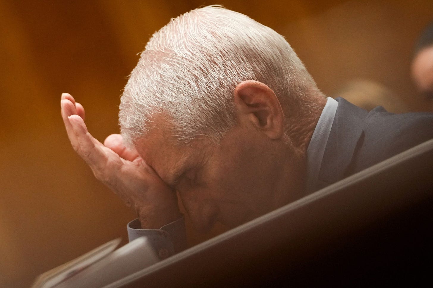 Anthony Fauci leaning his head against his hand. Anthony Fauci leaning his head against his hand.