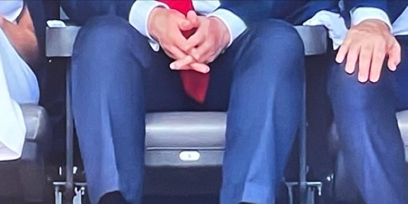 VIDEO: "Decaying" Hands, Swollen Ankles, Legs, And Face - Passing Out Mid Press Conference - Donald Trump is Extremely Unwell