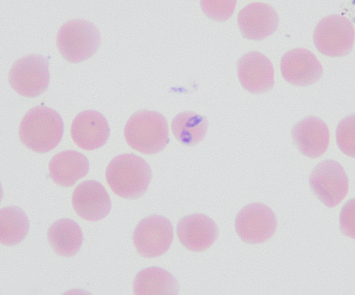 Left: B. theileri spirochete; Right: RBC in center contains two Babesia piroplasms