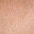 Decoding how to care for your skin in the winter months 